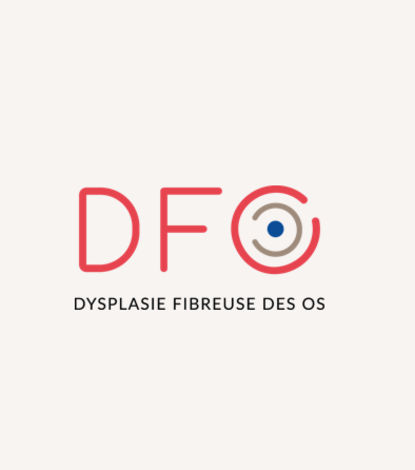 DFO